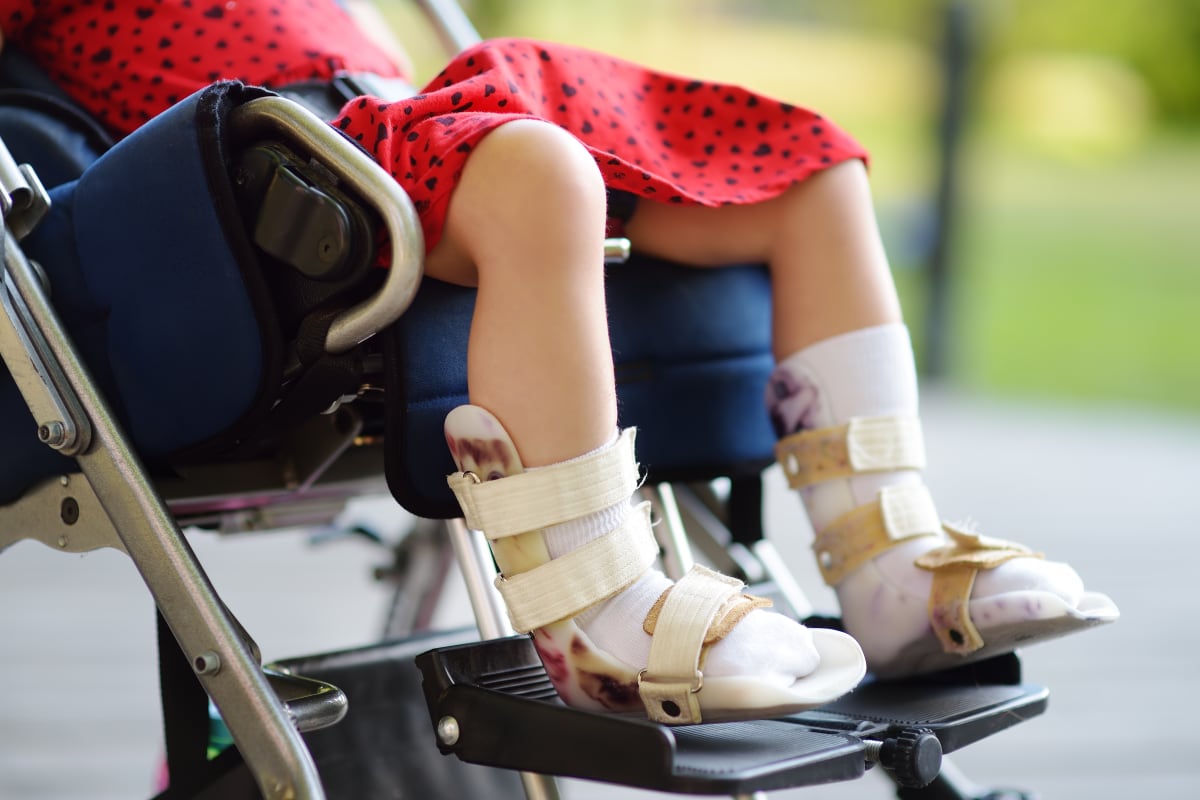 a little girl in a wheelchair with custom foot braces